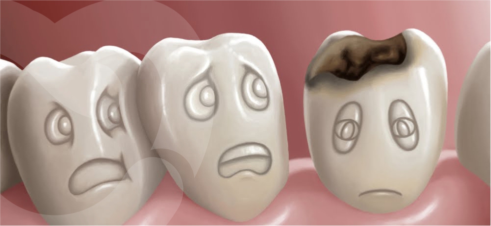 Cavity Care Guide: Everything You Need to Know