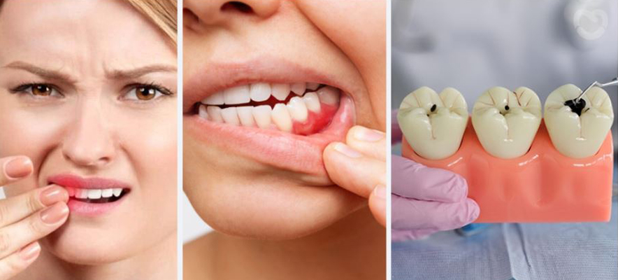 Common Dental Problems in Adults
